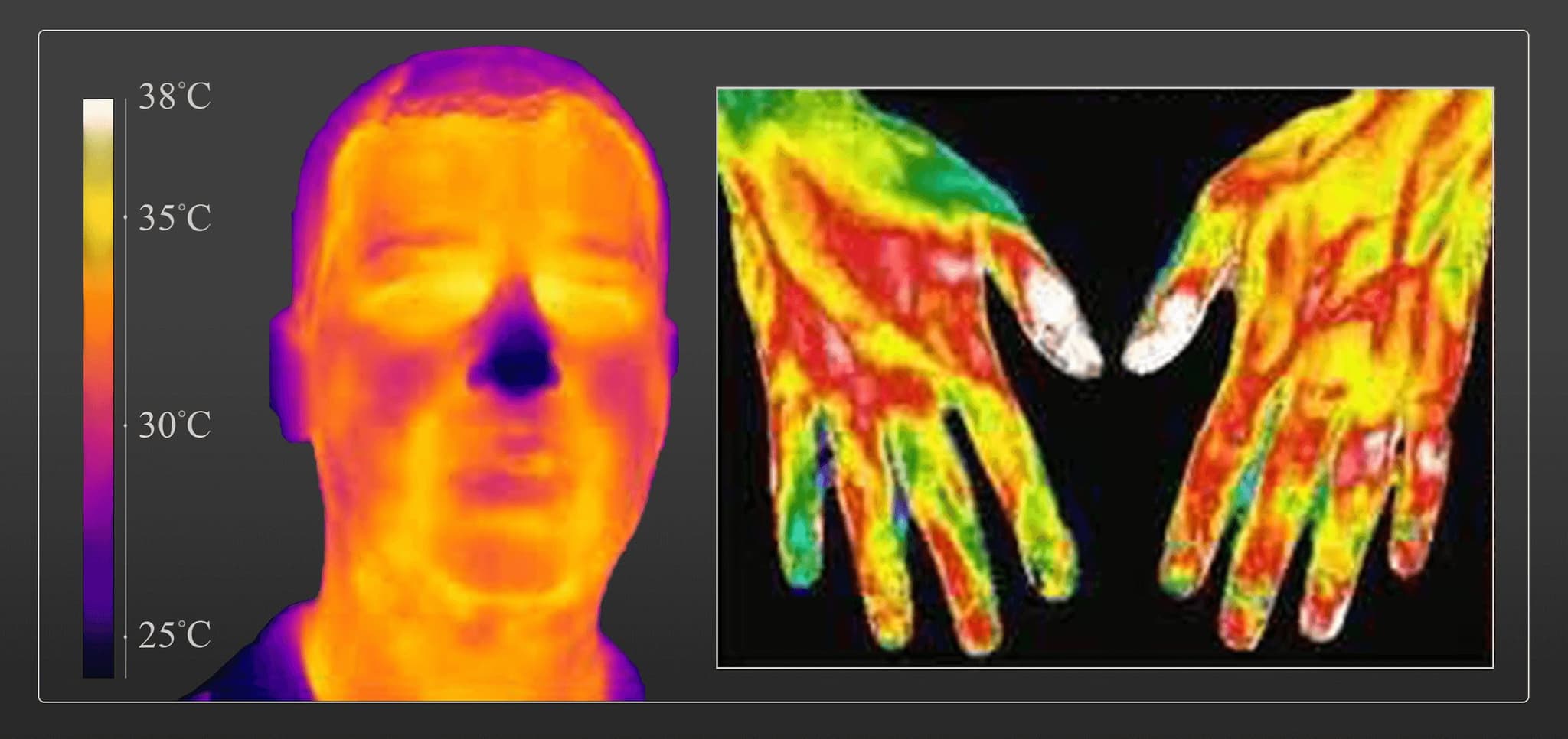 Body thermography